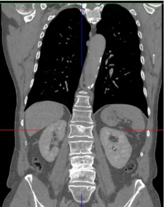 FIGURE 3.4: Illustration of abdominal organs from CT image in the frontal view 