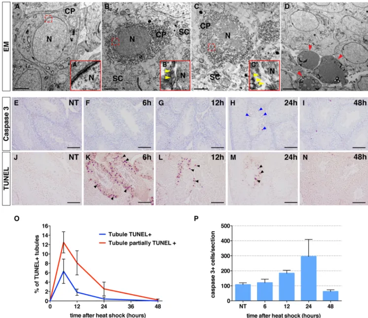 Fig 5. Mild hyperthermia induces germ cell necrosis during mouse spermatogenesis. (A-D) Electron micrographs of non-treated (A) or heat-shocked mice testes at 6 (B-C’) and 24 hours (D) after heat shock, showing cellular morphological hallmarks of necrosis 