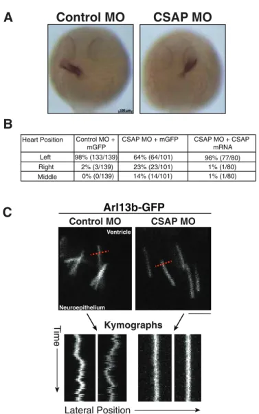 FIGURE 6:  CSAP is required for heart laterality and cilia beating. 