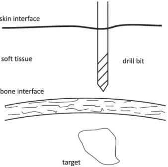 Fig. 1 Illustration of a drill about to penetrate a layer of bone.
