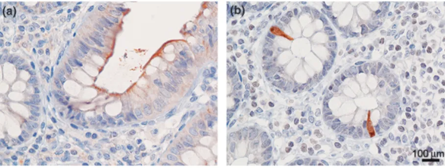 Figure 3. Adrenomedullin (AM) immunoreactivity of the human colonic mucosa. Immunoreactivity for AM is observed in the apical side cytoplasm of the surface epithelia and at the luminal surface (a)