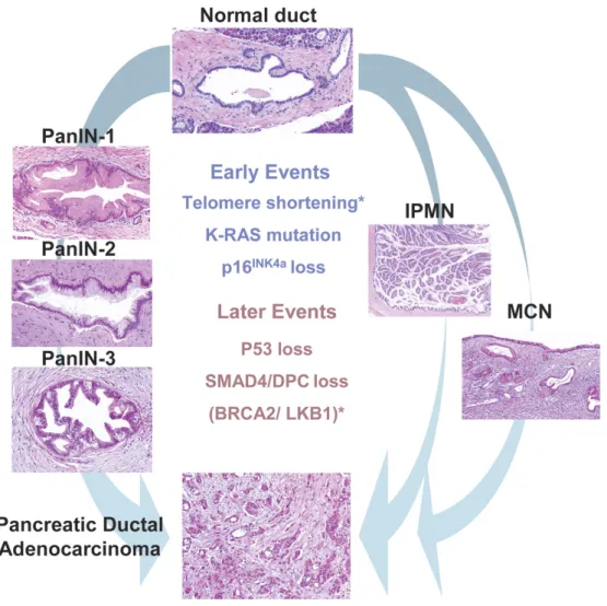 Figure 6. Pancreatic precursor lesions and genetic events involved in PDAC progression (Hezel et al., 2006)
