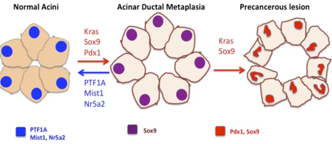 Figure  8.  Acinar-to-ductal  metaplasia arising  from  normal  acini  is  an  origin  of  pancreatic  cancer  (Schofield and Pasca di Magliano, 2015)