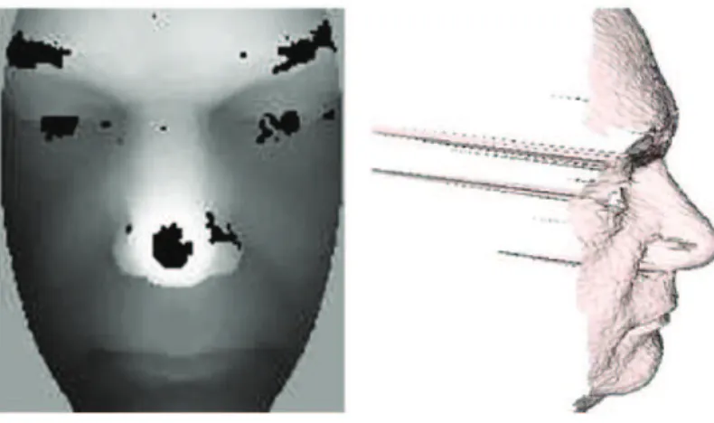 Figure 2.2: Holes and spikes on a 3D face scan