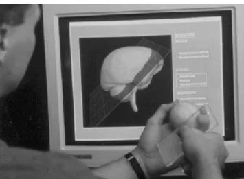 Fig. 5 The passive props for neurosurgery [5]