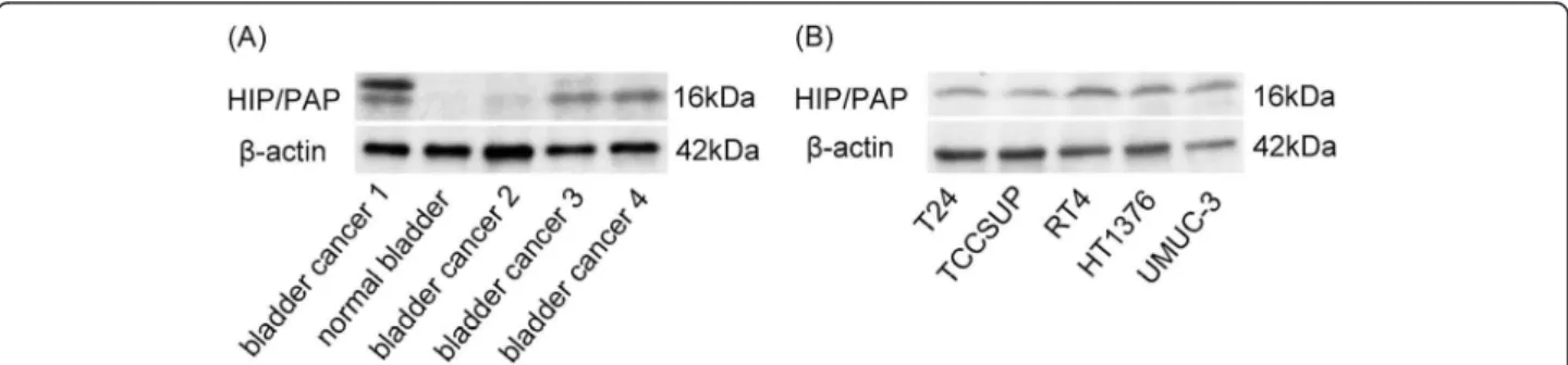 Figure 1 Expression of HIP/PAP protein in tissue samples and BCa cells. (A) Expression of HIP/PAP protein in a normal bladder tissue and BCa specimens