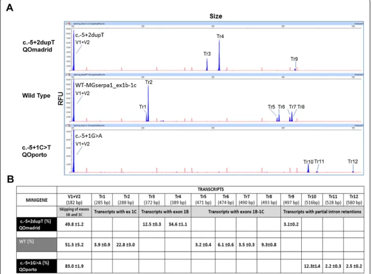 Figure 5 Transcripts detection in wt and splicing mutation minigenes. A) Fluorescent capillary electrophoresis of RT-PCR products generated by the wild type, c.-5 + 2dupT and c.-5 + 1G &gt; A minigenes