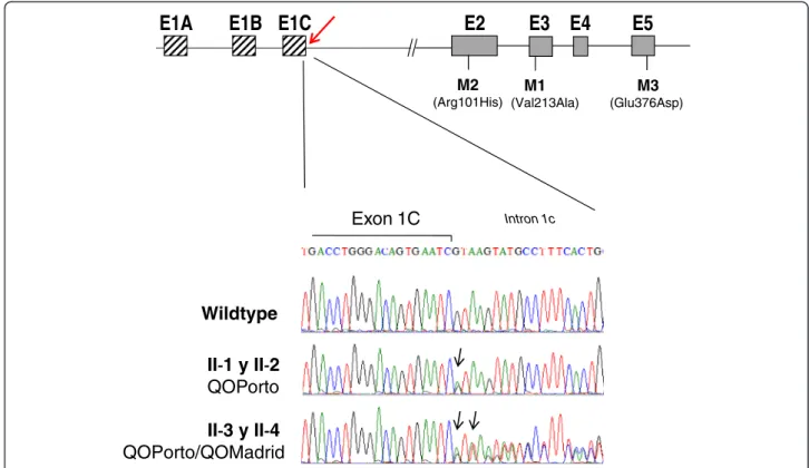 Figure 2 Results of direct sequencing of the exon 1C-inton 1C boundary region. Schematic representation of SERPINA1 gene is represented in the top showing position of the non-coding exons 1A, 1B and 1C and coding exons E2 to E5