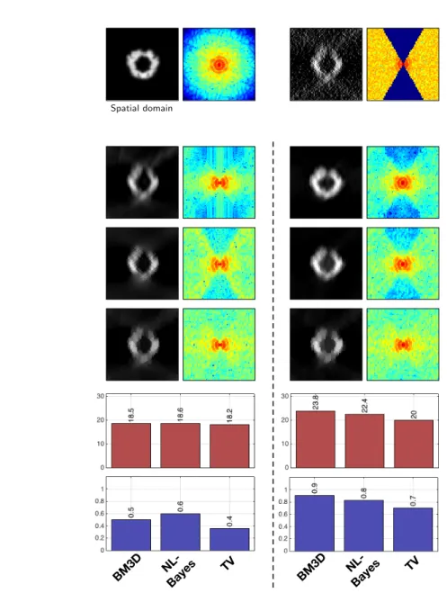 Figure 3: Dataset A (2D): comparison of denoising algorithms. First, we compare conventional denoisers (left column) to our MH method (right column)