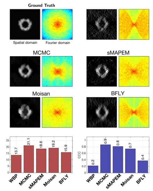 Figure 9: Dataset A (2D): comparing our approach to competitive methods: i/ sMAPEM, a regularized tomographic reconstruction method designed to achieve isotropic resolution; ii/ the Moisan’s method designed to extrapolate missing regions in Fourier space;