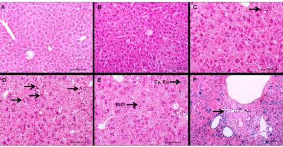 Fig 7. Liver histology of control and 213 Bi-BSA injected mice. (A) Control liver, 26 weeks post-injection, (B) livers of mice 26 weeks after injection of 3.7 MBq 213 Bi-BSA, and (C, D, E, F) livers of mice 26 weeks after injection of 11.1 MBq 213 Bi-BSA