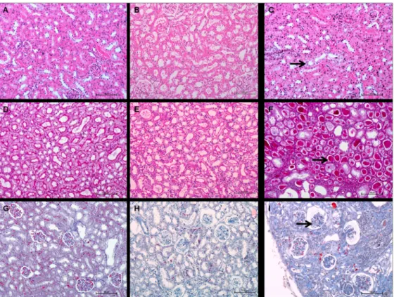 Fig 9. Kidney histology of control and 213 Bi-BSA injected mice. Comparison between kidneys of (A, D, G) control animals, (B, E, H) kidneys of mice 35 weeks after injection of 3.7 MBq of 213 Bi-BSA, (C and I) 26 weeks after injection of 11.1 MBq of 213 Bi-