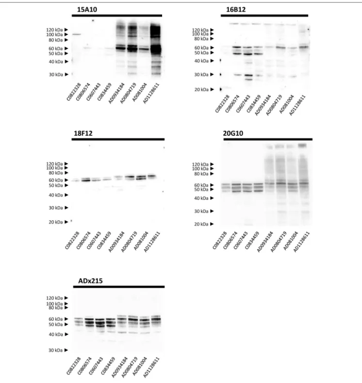 FIGURE 5 | Biochemical validation in human brain extracts. Western blot analysis of homogenates of human frontal cortex