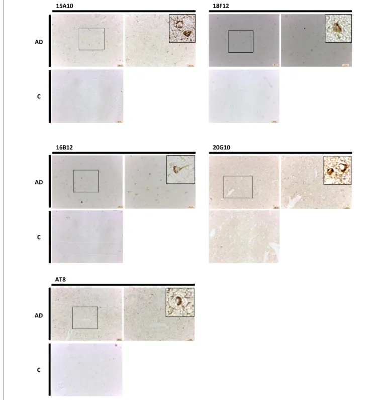 FIGURE 8 | Immunohistochemistry in human brain sections. Pictures represent immunohistochemical stainings performed using mAbs 15A10, 16B12, 18F12, and 20G10 on different regions of the cortex of human control subjects (C) and AD patients