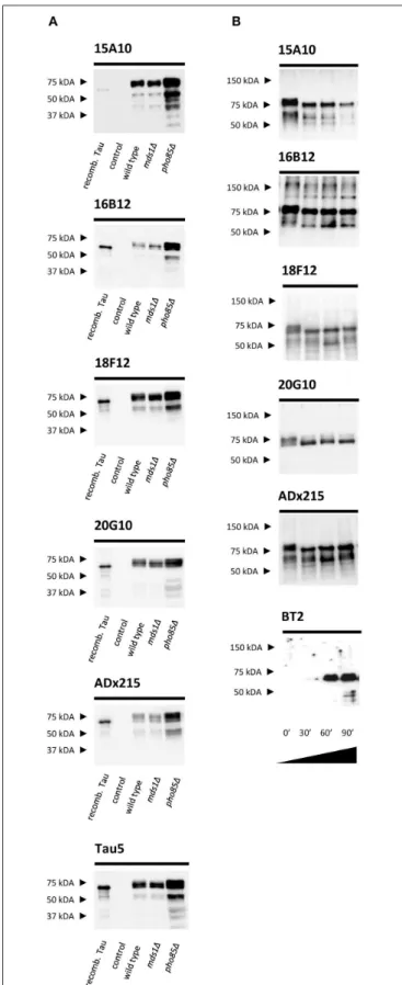 FIGURE 1 | Characterization of the novel mAbs in yeast. (A) Western blot analysis of total protein extracts from different BY4741 yeast strains