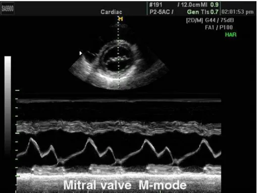 Figure 2.3: M-mode and B-mode images. (top) B-mode image representing a heart section