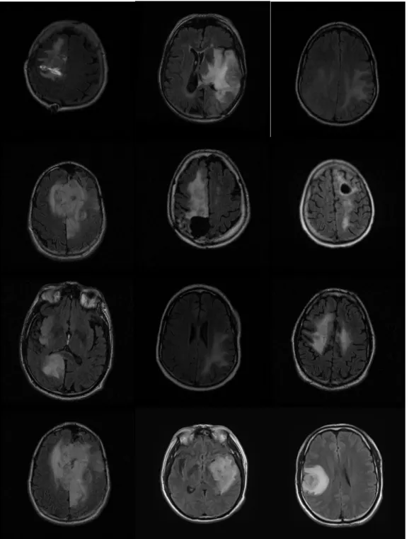 Figure 4.3 The MRI examples of Patient 2 to Patient 13. 