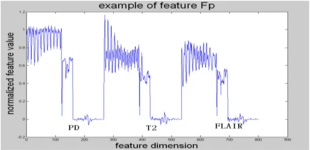 Figure 4.4 Example of a feature vector. 