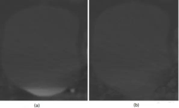 Figure 3. In (a) Bladder RoI preprocessing before. Lower bladder region had different appareance because filling bladder