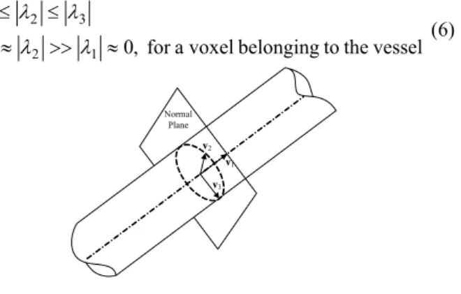 Fig. 3: Eigenvector approximate the local vessel direction
