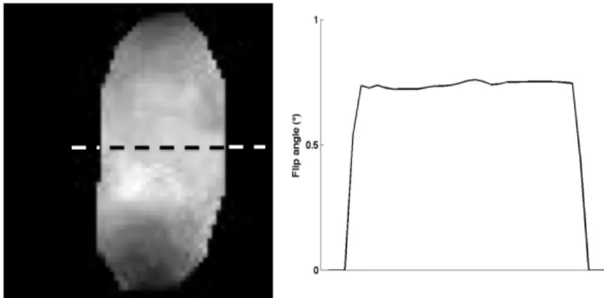 Figure 8 Flip-angle map and corresponding cross-section in the MnCl 2  tube at 4.7T for a  nominal flip angle of 4° 