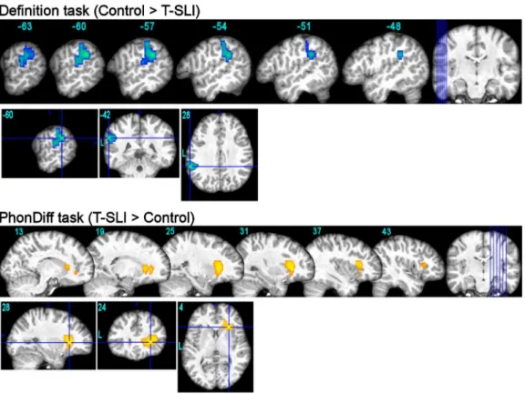 Fig.  2.  fMRI  between-group  comparisons  for  definition  and  phon-diff  tasks  (p&lt;0.05  FWE- FWE-corr.)