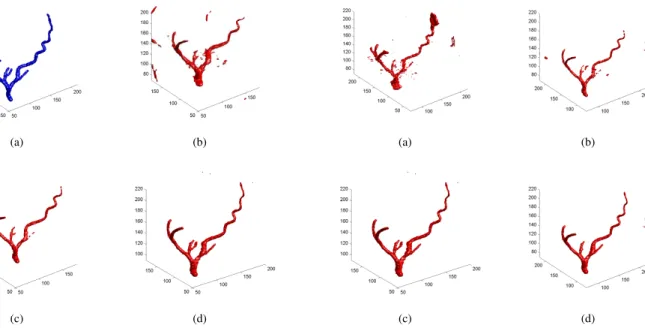 Fig. 3. A result of the coronary reconstruction from 4 projections of phase 1(RAO 60 o , RAO 30 o , LAO 0 o , LAO 30 o ) (a) original 3D coronary tree without the background, (b) reconstruction using L2 norm penalty (MSE 14.38%), (c) L1 norm (MSE 7.12%) (d