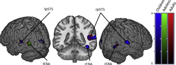 Fig. 2. Brain activity when contrasting Angry &gt; Neutral Bodies in Children, Adolescents and Adults