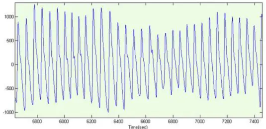 Figure 2.3: An example of the PPG.