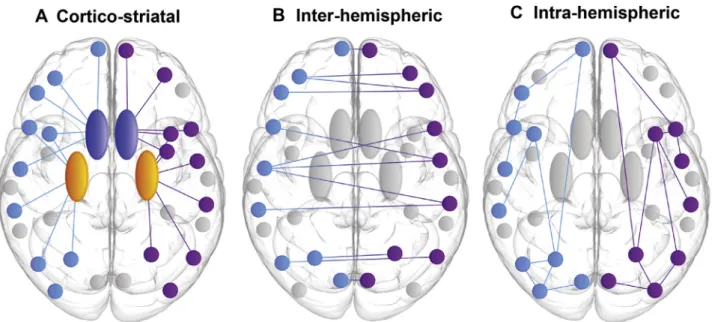 Figure 1. Schematic illustrating subgroups of regional white matter connectivity. (A) Corticostriatal: connections between cortex and striatum (caudate and putamen) for each cortical region of interest