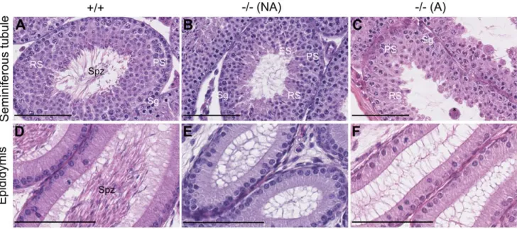 Figure 1. Incompletely penetrant blockage of spermiogenesis in Celf1 2/2 mice during the first wave of spermatogenesis.