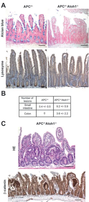 Figure 9 Loss of Atoh1 enhances the tumour formation induced by Apc loss. Alcian blue staining and immunostaining for lysosyme in Apc +/ and Apc +/ Atoh1 / mice (A)