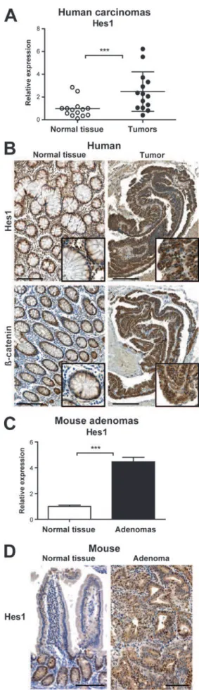 Figure 1 Induction of Hes1 expression in human and murine intestinal carcinogenesis. Analysis of Hes1 mRNA levels by quantitative reverse transcription e PCR (RT e PCR) in human colorectal cancer (CRC) and in normal tissue (A)