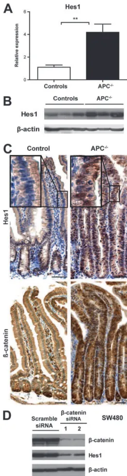 Figure 3 Hes1 expression is correlated with Wnt/ b -catenin signalling.