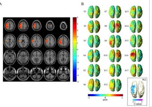 Figure 6. Cortical sources of the syllable congruency effect at the [350 550] window. (A)  Statistical maps (masked at cluster-corrected P< 0.05) comparing the source reconstructed  SSVEPs between the congruent and incongruent conditions localized the s