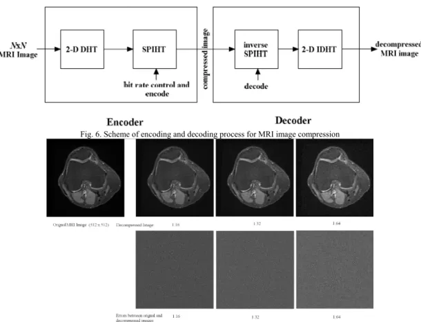 Fig. 6. Scheme of encoding and decoding process for MRI image compression 