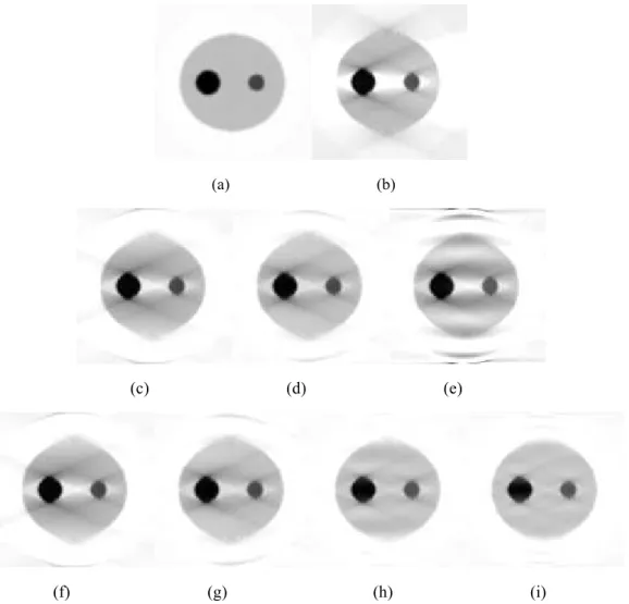 Figure 4. Reconstruction results. (a) Original grey-level image; (b) Reconstruction from  incomplete projections (25 0 -155 0 ) using FBP method; (c), (d) and (e) Reconstructions  from incomplete projections using geometric moments with maximum order M = 5