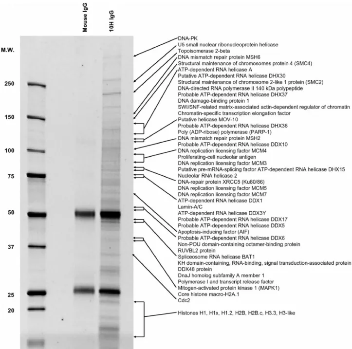 Figure 5. SDS–PAGE analysis of pADPr-associated proteins from MNNG-treated and PARG-silenced SK-N-SH cells after immunoprecipitation with anti-pADPr antibodies