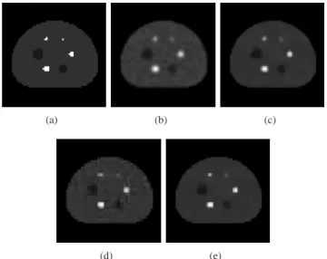 Fig. 10. Parameter β versus contrast recovery coefficient (CRC) on pixel of interest at the center of phantom for different MAP methods.