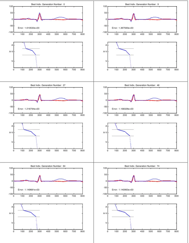 Figure 5.  Model adaptation to a sinus beat in record 100 of the MIT-BIH database. Each panel shows  the best individual of some populations of the EA, presenting the observed beat (thicker line) and the  synthesized beat (finer line) along with its ladder