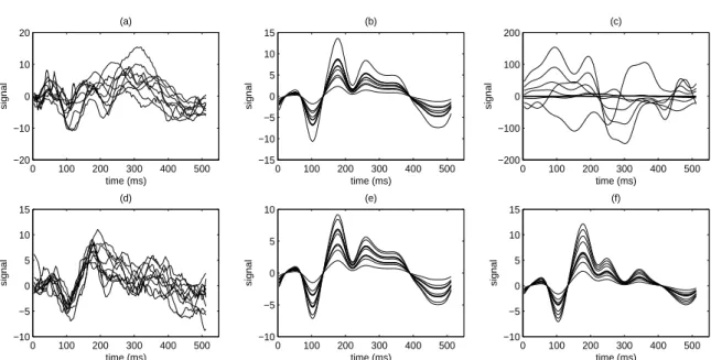 Fig. 3.1: Les ondes P300 associées respectivement à l’effet placebo (a) et à l’effet du traitement (d)