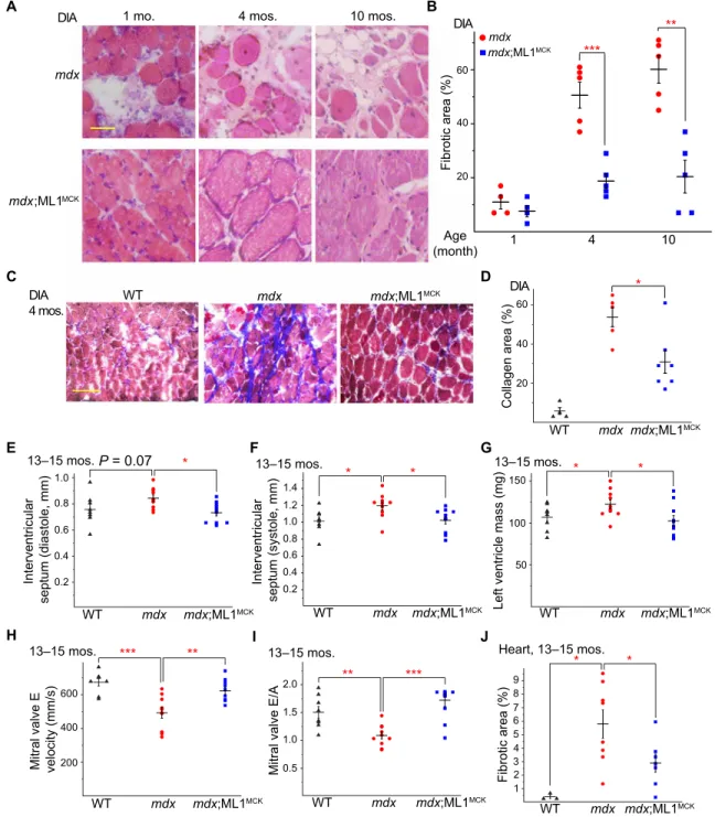 Fig. 3. Transgenic ML1 overexpression ameliorates myopathies in aged mdx mice. (A) H&amp;E staining of DIA isolated from mdx and mdx;ML1 MCK  mice at the age of  1, 4, and 10 months