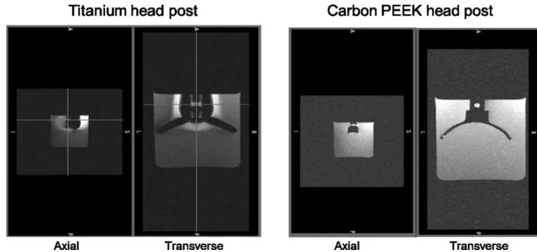 Figure 2. Comparison of MR signal distortion around head posts made of titanium (left) and  carbon PEEK (right)