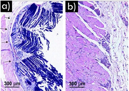 Figure 1.2.   Micrographies révélant (a) le tissu fibreux se formant à l’interface entre un  alliage de Co et l’os (indiqué par les flèches) et (b) l’intime interconnexion entre l’implant en  Ti et l’os montrant la capacité d’ostéo-intégration du matériau