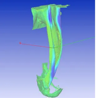 Figure 23 : Exemple d'une reconstruction 3D à l'aide du logiciel Focus Inspection avec axe x mésiodistal rouge, axe y  vestibulolingual vert et axe z coronoapical bleu