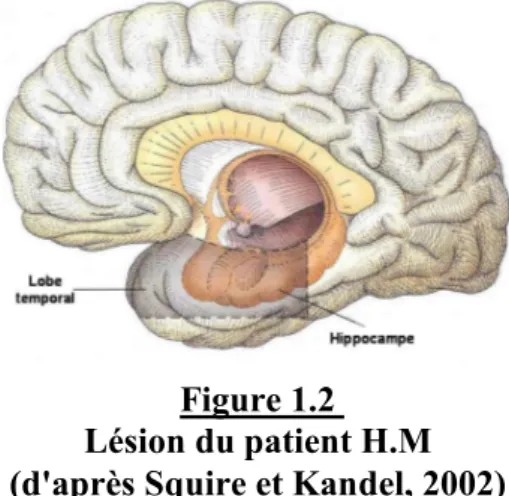 Figure 1.2   Lésion du patient H.M   (d'après Squire et Kandel, 2002) 