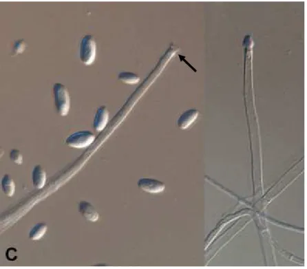 Figure 6 : Microconidies 