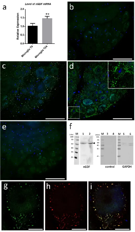 Figure 7. Induction of ngdf mRNA level and immunolocalization of nGDF protein. (a) q-PCR results  indicate  that  ngdf  mRNA  is  present  in  freshly  dissociated  (T0h)  microglial  cells  and  significantly  increases in cultured microglia (T24h)