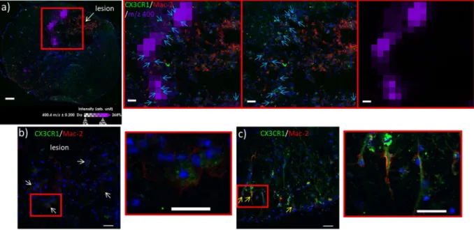 Figure 6. (a) Co-registration of the ion image of palmitoylcarnitine AC(16:0) (m/z 400.3, violet) with the  mosaic of bright field images of the spinal cord section taken 10 days after SCI and immunostained against  CX3CR1 (green) and Mac-2 (red)