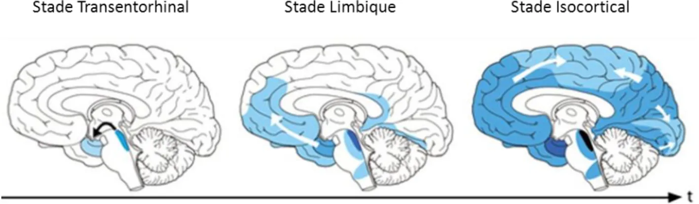Figure  3 :  Schéma  représentant  la  progression  des  dégénérescences  neurofibrillaires  dans  le  cerveau  de  patients  atteints de la MA (Jucker and Walker, 2013)